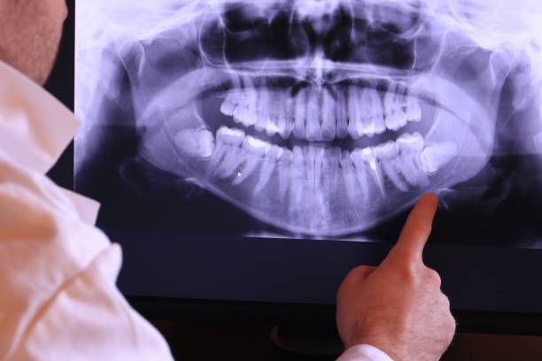 Best Emergency Dentist for Knocked-Out Tooth in Streamwood, IL