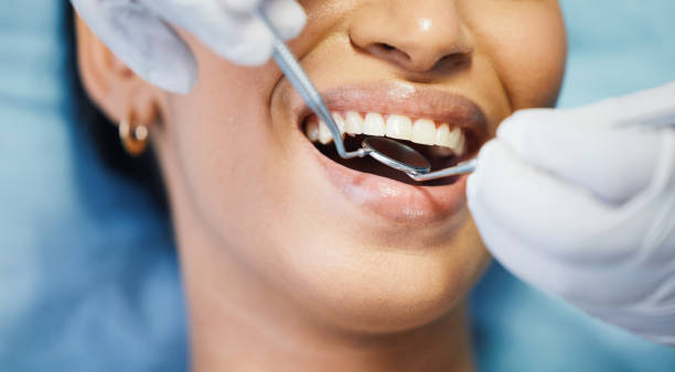 Best Emergency Dentist for Special Needs Patients in Streamwood, IL