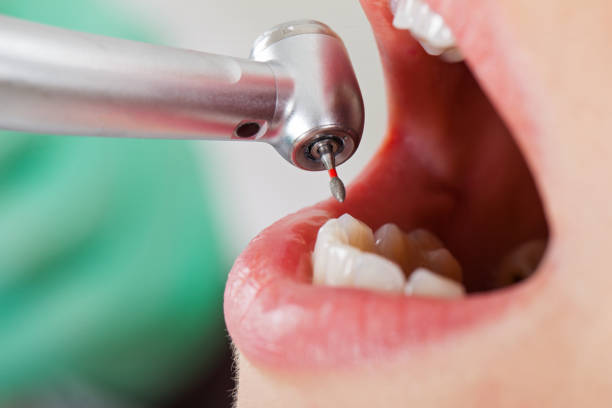 Best Pediatric Emergency Dentist in Streamwood, IL